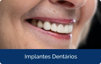 implantes - Copia